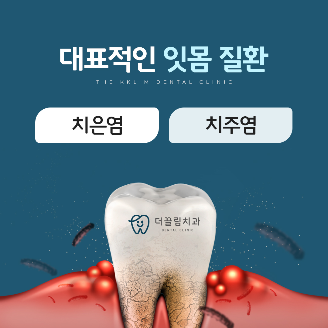 치은염, 치주염 치료 더끌림치과의원