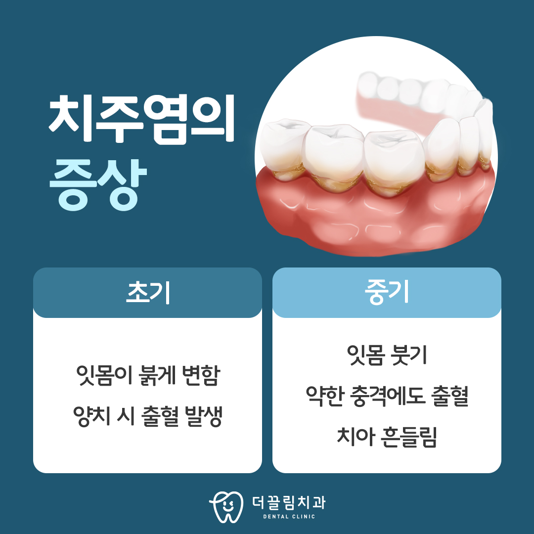 치주염 증상