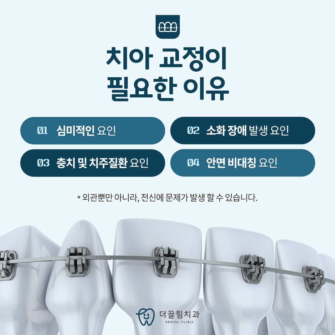 치아교정이 필요한 이유